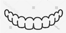 Clear Aligners