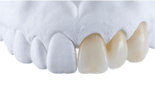 Zirconia